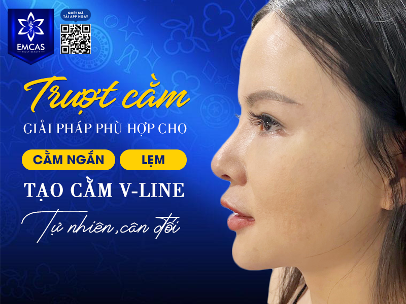 Trượt Cằm - Bí Quyết Tạo Cằm V-Line