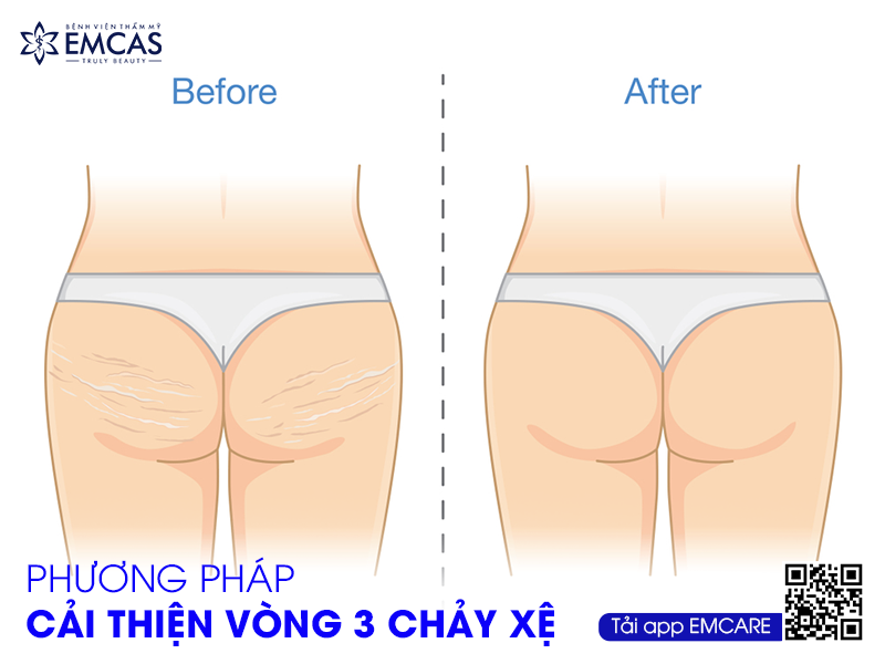 Cách Cải Thiện Vòng 3 Chảy Xệ Hiệu Quả Cho Dân Văn Phòng