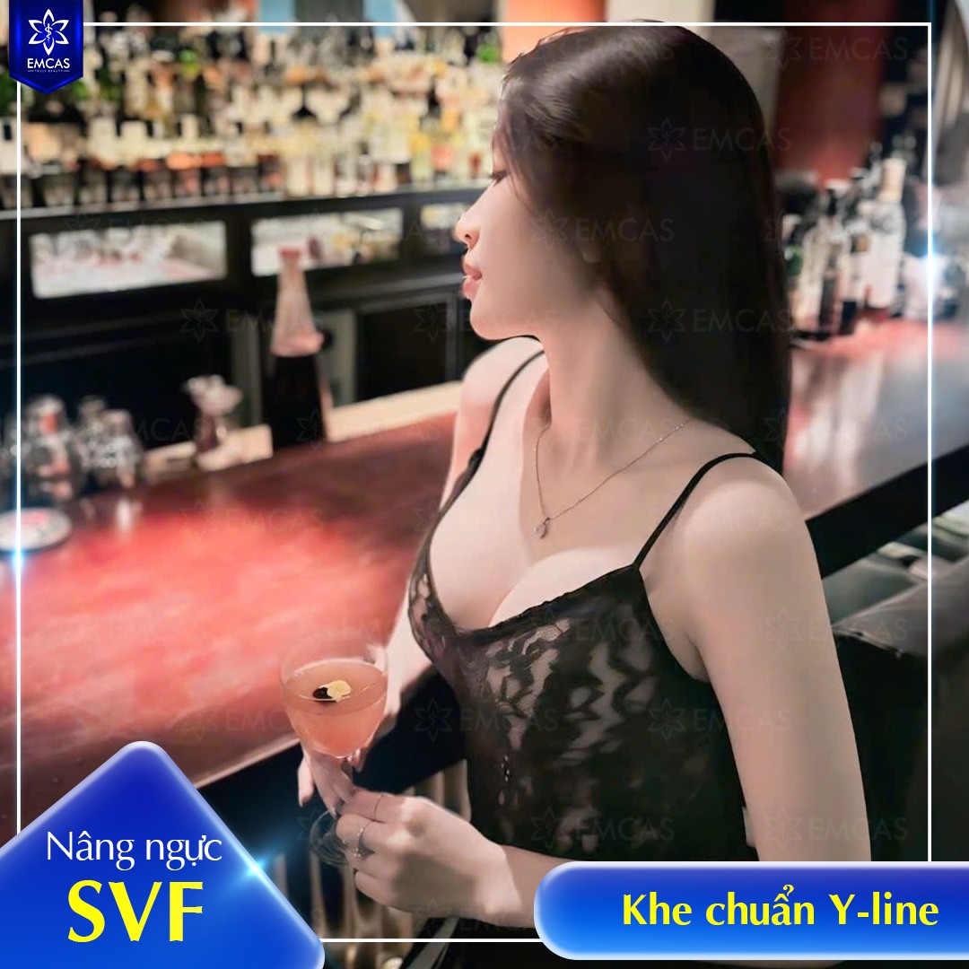 Làm Đẹp Tự Nhiên Với Phương Pháp Nâng Ngực SVF