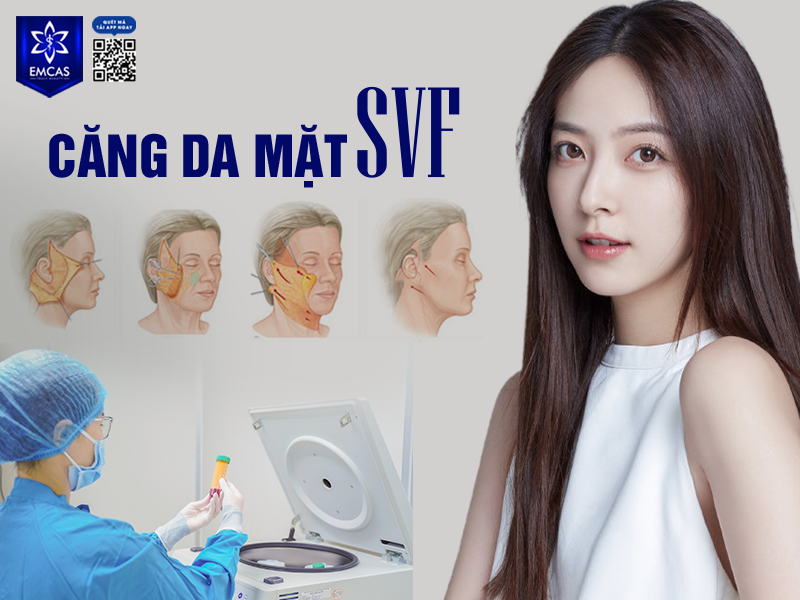  Lợi Ích Khi Căng Da Mặt SVF Tại EMCAS