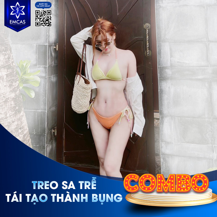 Lấy Lại Vòng 2 Thon Gọn Sau Sinh Nhờ Tái Tạo Thành Bụng