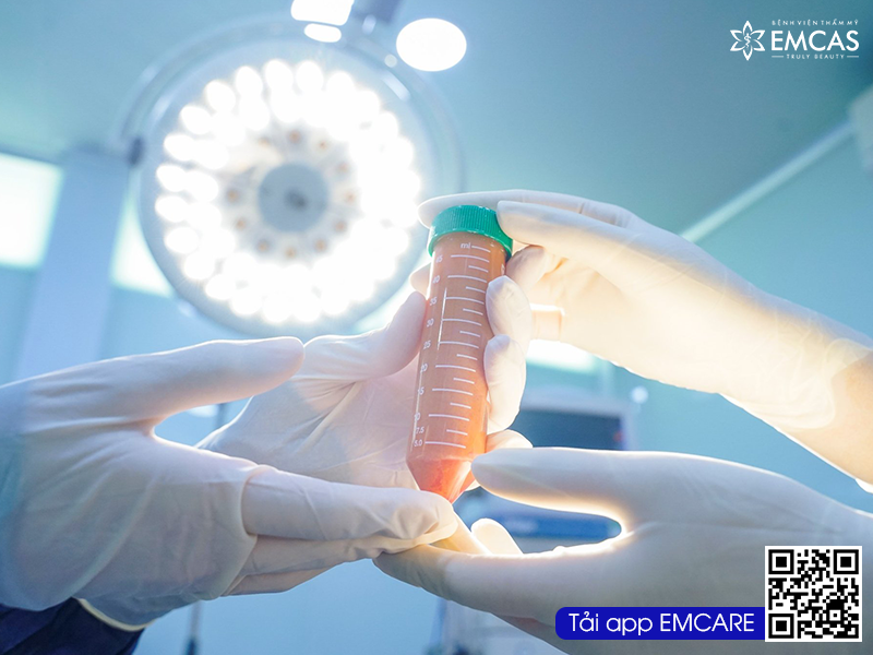 NÂNG NGỰC BẰNG MỠ TỰ THÂN