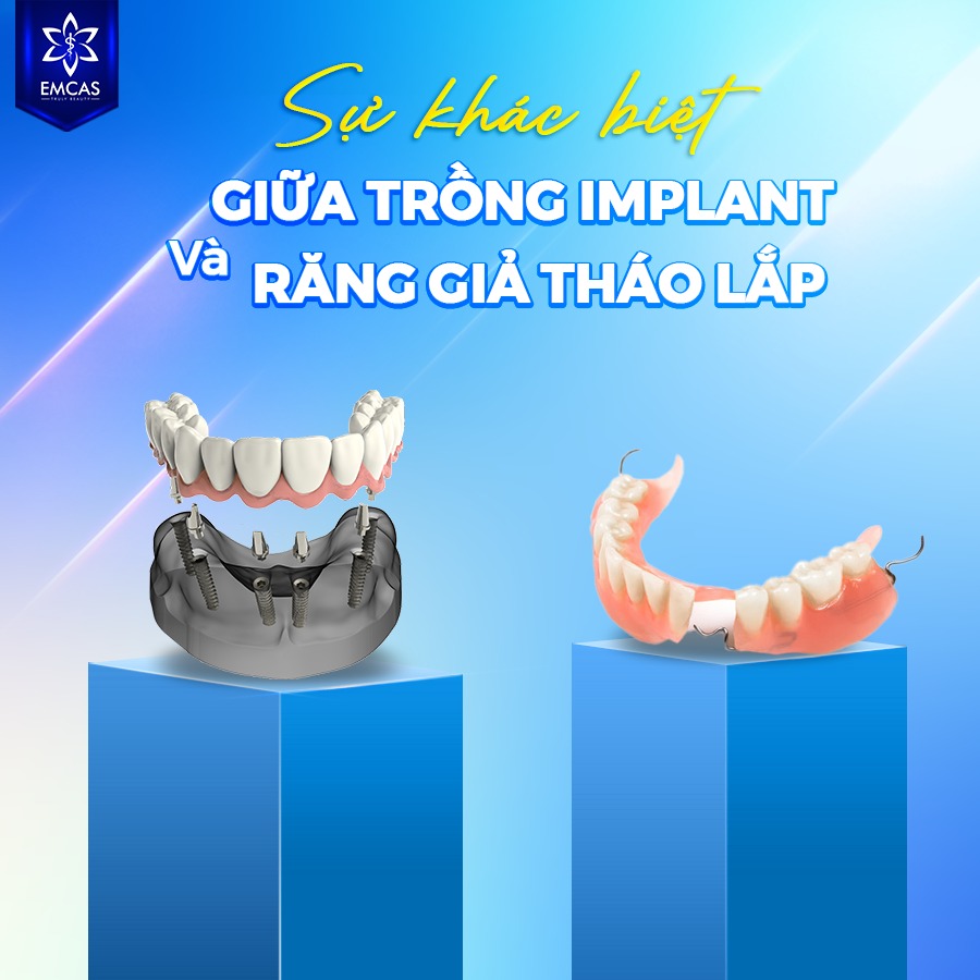 Ứng Dụng SVF Trong Trồng Răng Implant