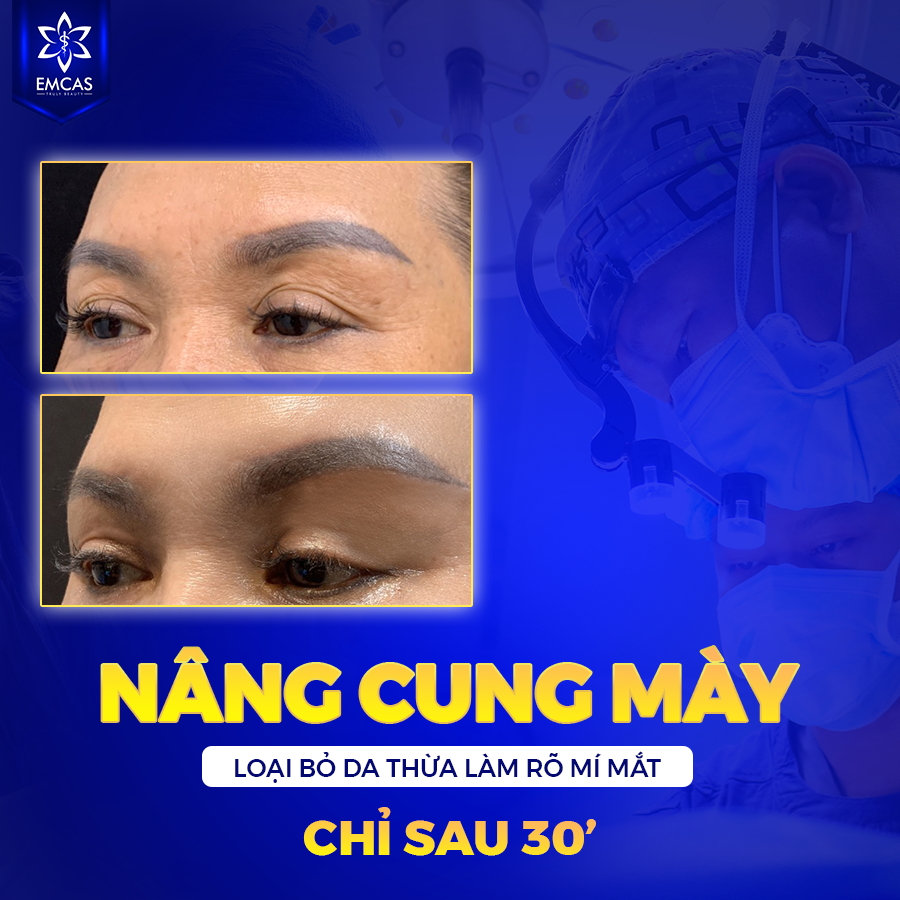 NÂNG CUNG MÀY NỘI SOI