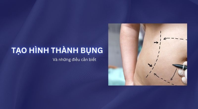 Tạo Hình Thành Bụng Và Những Điều Cần Biết