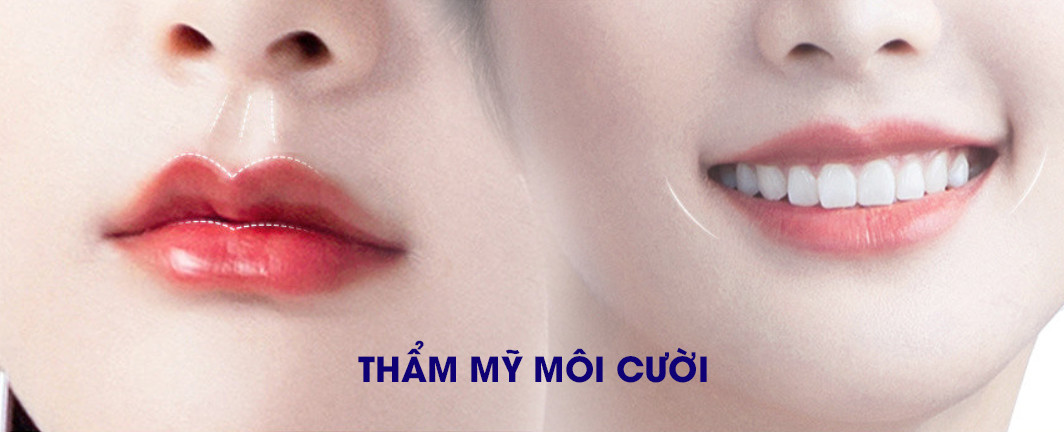 THẨM MỸ MÔI CƯỜI