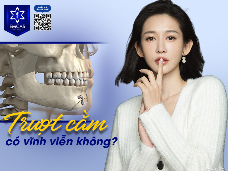 Trượt Cằm - Bí Quyết Tạo Cằm V-Line
