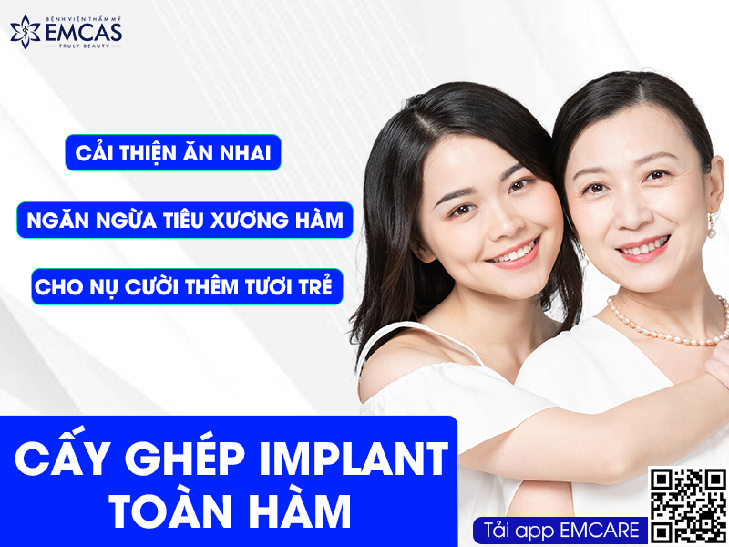 CẤY GHÉP IMPLANT TOÀN HÀM