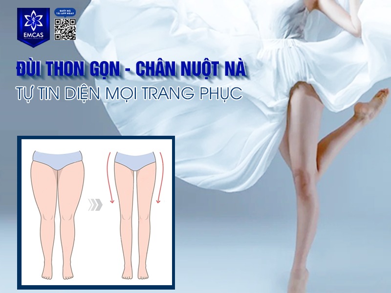 Hút Mỡ Đùi Có Giúp Đôi Chân Thon Gọn Không?