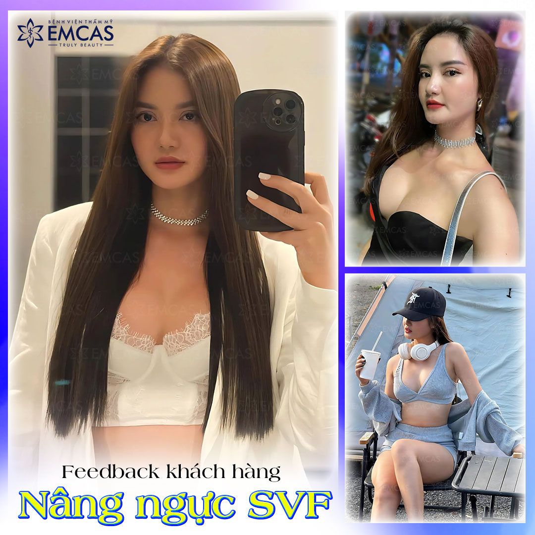 Nâng Ngực SVF - Ứng Dụng Công Nghệ Tế Bào Gốc