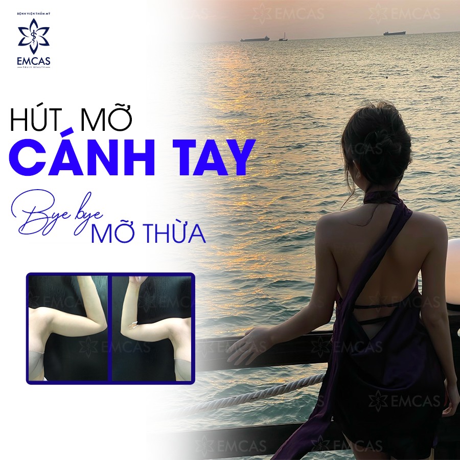 HÚT MỠ CÁNH TAY