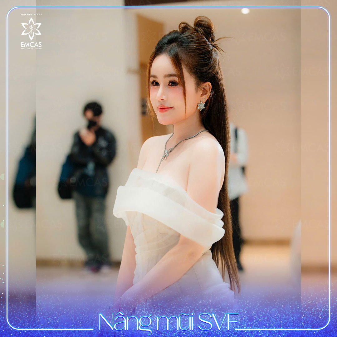 Lý Do Nên Chọn Nâng Mũi SVF Thay Vì Phương Pháp Truyền Thống