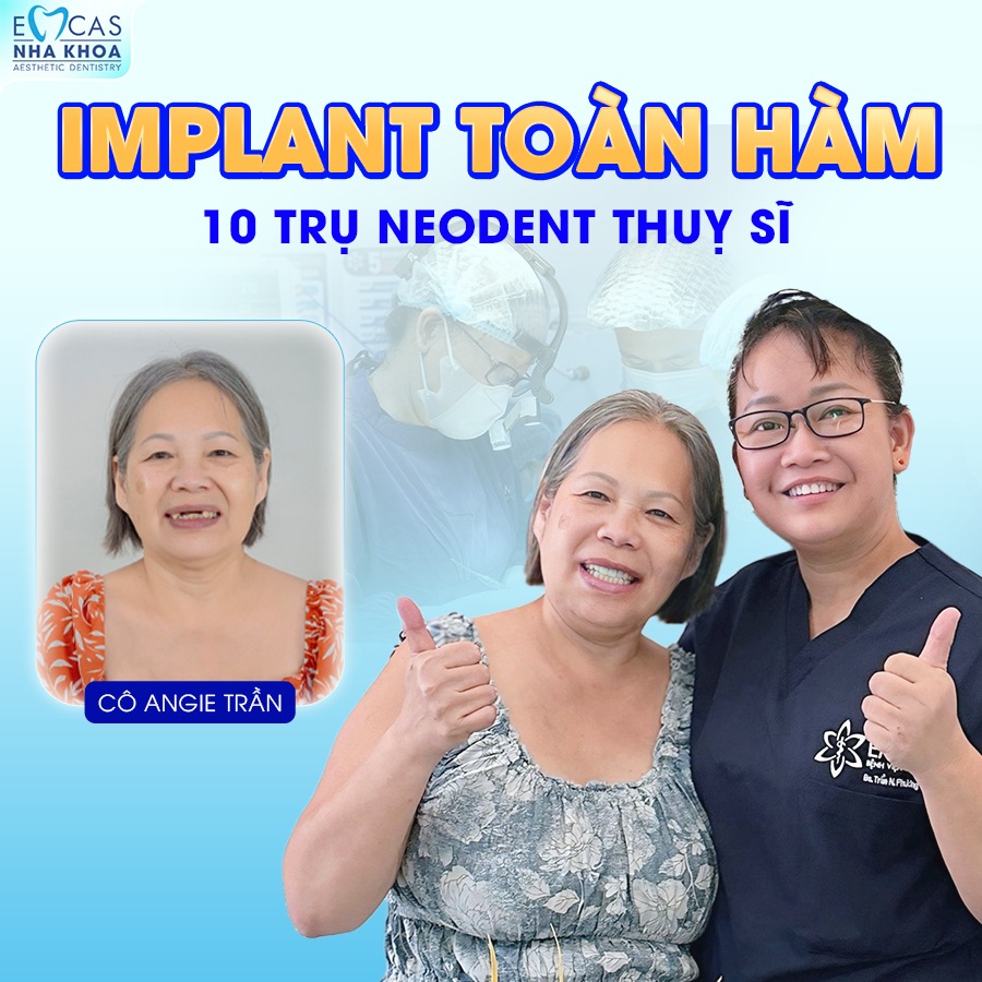 CẤY GHÉP IMPLANT TOÀN HÀM