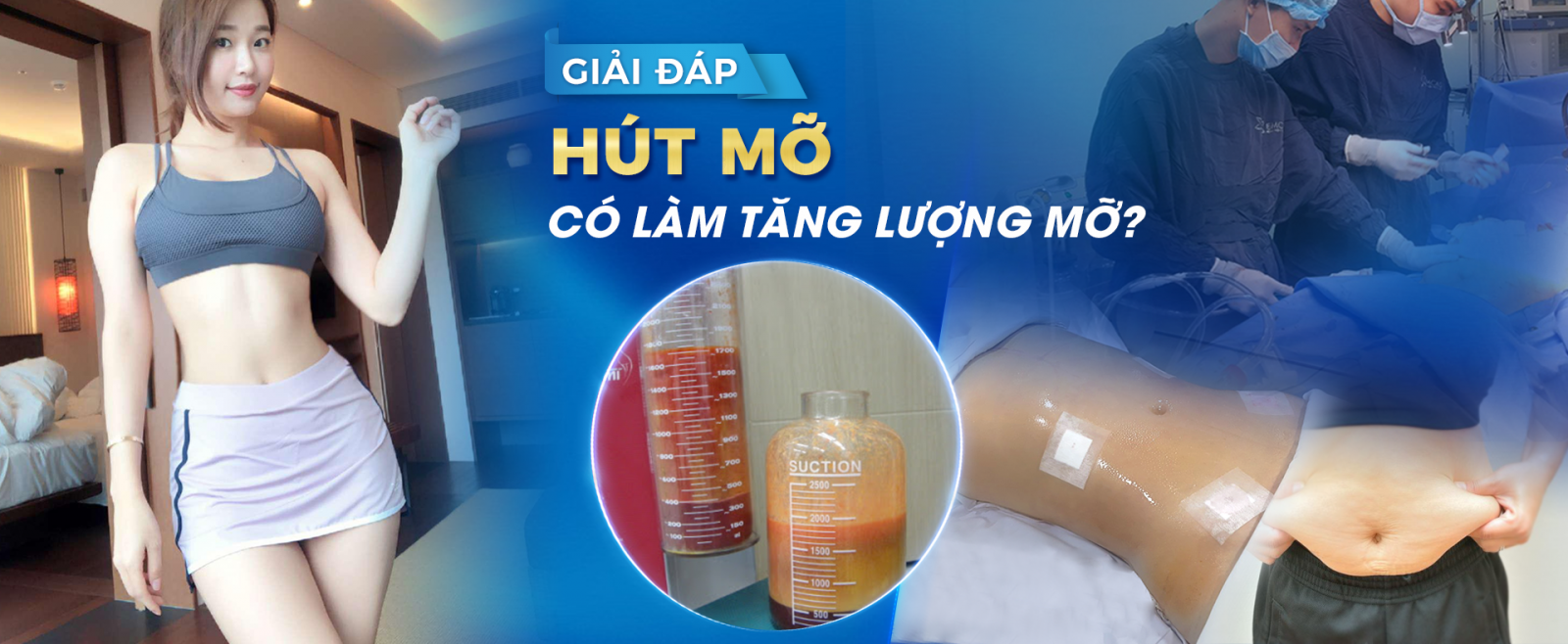 [GÓC GIẢI ĐÁP] HÚT MỠ CÓ LÀM TĂNG LƯỢNG MỠ?