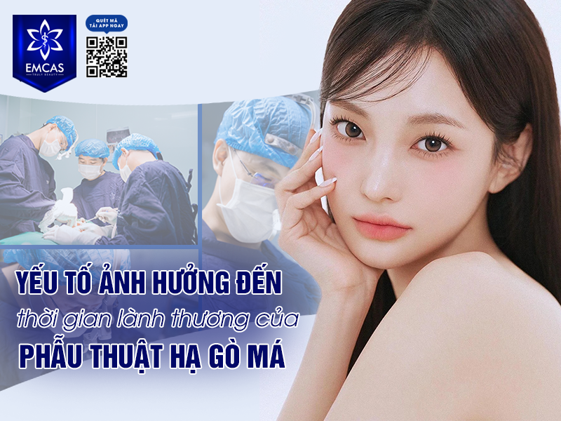 Hạ Gò Má Bao Lâu Thì Lành? Bí Quyết Chăm Sóc Sau Phẫu Thuật